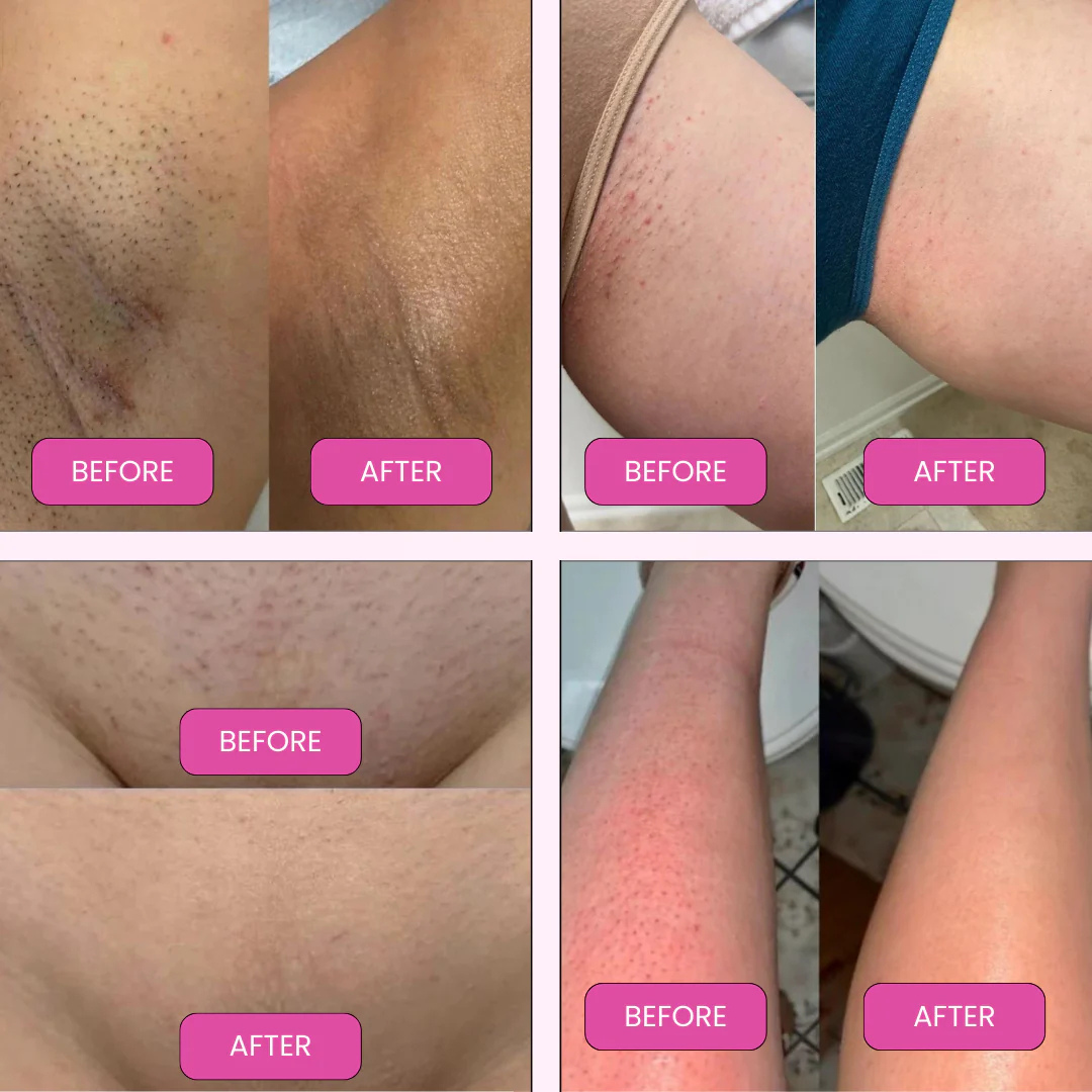 SmoothTrim™ | Gentle on Skin, Tough on Hair